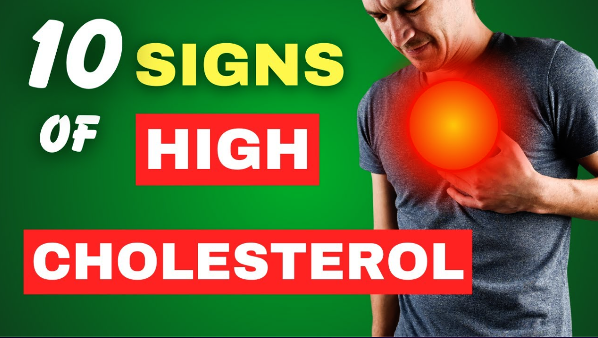 5 Warning Signs of High Cholesterol