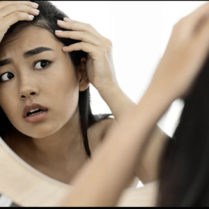 Best Dermatologists for Hair Loss in Dubai